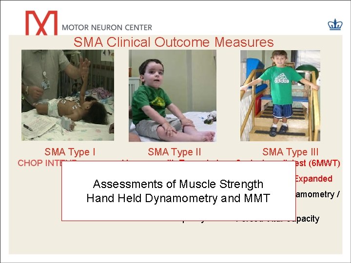 SMA Clinical Outcome Measures SMA Type I CHOP INTEND SMA Type III Hammersmith Expanded