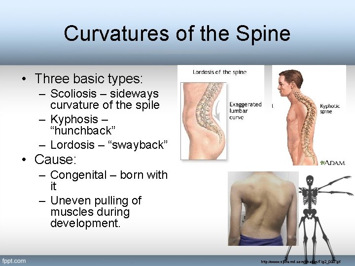 Curvatures of the Spine • Three basic types: – Scoliosis – sideways curvature of