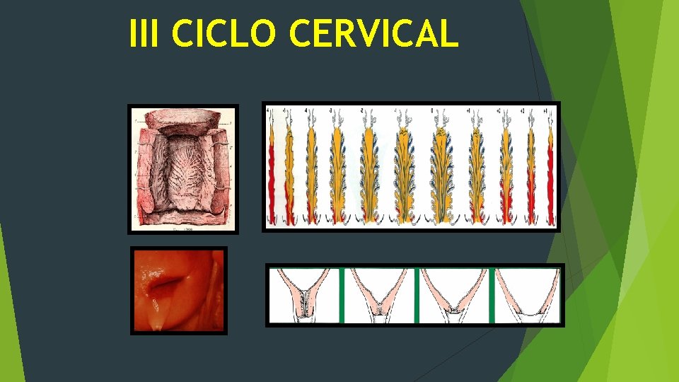 III CICLO CERVICAL 