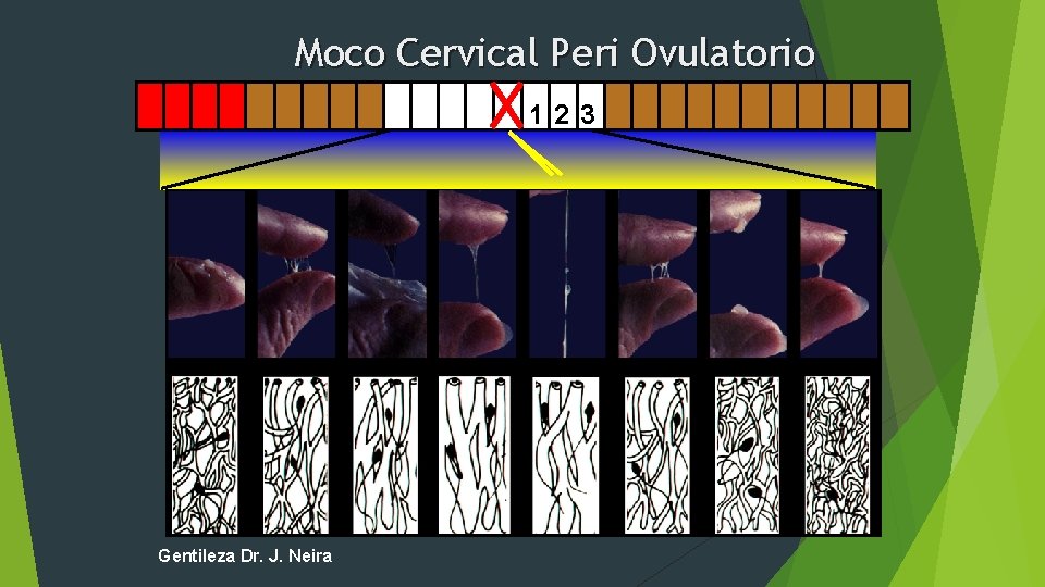 Moco Cervical Peri Ovulatorio 123 Gentileza Dr. J. Neira 