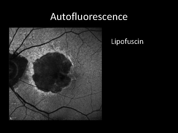 Autofluorescence Lipofuscin 