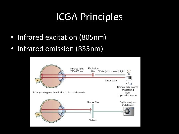 ICGA Principles • Infrared excitation (805 nm) • Infrared emission (835 nm) 