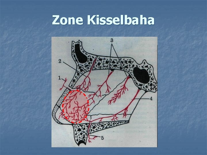 Zone Kisselbaha 