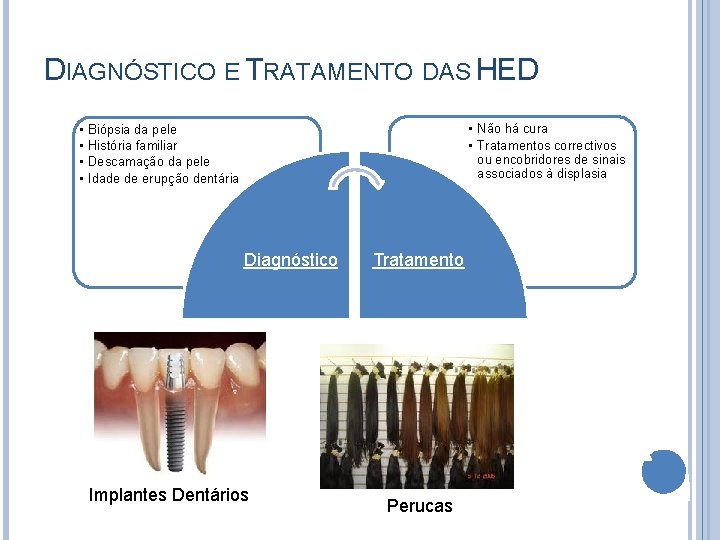 DIAGNÓSTICO E TRATAMENTO DAS HED • • • Não há cura • Tratamentos correctivos