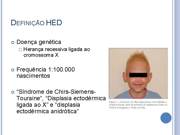 DEFINIÇÃO HED Doença genética � Herança recessiva ligada ao cromossoma X Frequência 1: 100.