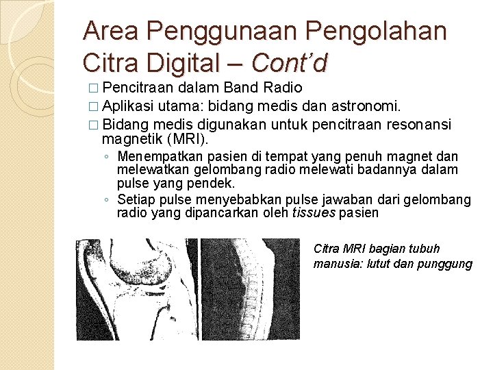 Area Penggunaan Pengolahan Citra Digital – Cont’d � Pencitraan dalam Band Radio � Aplikasi Area Penggunaan Pengolahan Citra Digital – Cont’d � Pencitraan dalam Band Radio � Aplikasi
