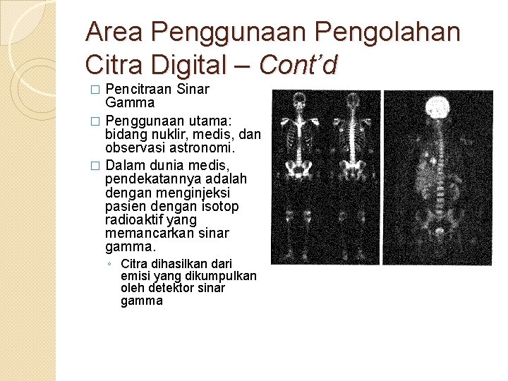 Area Penggunaan Pengolahan Citra Digital – Cont’d Pencitraan Sinar Gamma � Penggunaan utama: bidang Area Penggunaan Pengolahan Citra Digital – Cont’d Pencitraan Sinar Gamma � Penggunaan utama: bidang