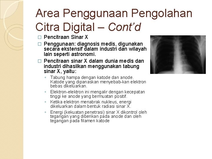 Area Penggunaan Pengolahan Citra Digital – Cont’d Pencitraan Sinar X � Penggunaan: diagnosis medis, Area Penggunaan Pengolahan Citra Digital – Cont’d Pencitraan Sinar X � Penggunaan: diagnosis medis,