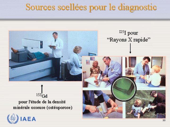 Sources scellées pour le diagnostic I 25 I pour “Rayons X rapide” 153 Gd