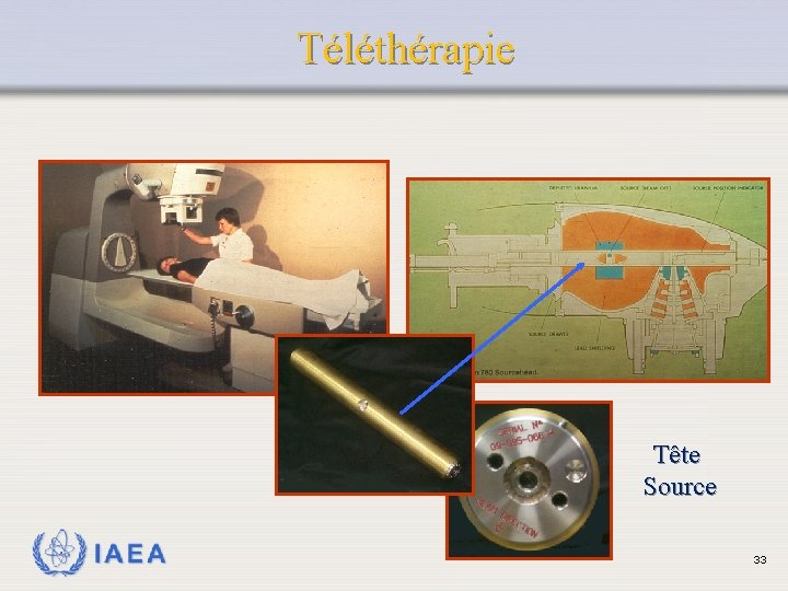 Téléthérapie Tête Source IAEA 33 