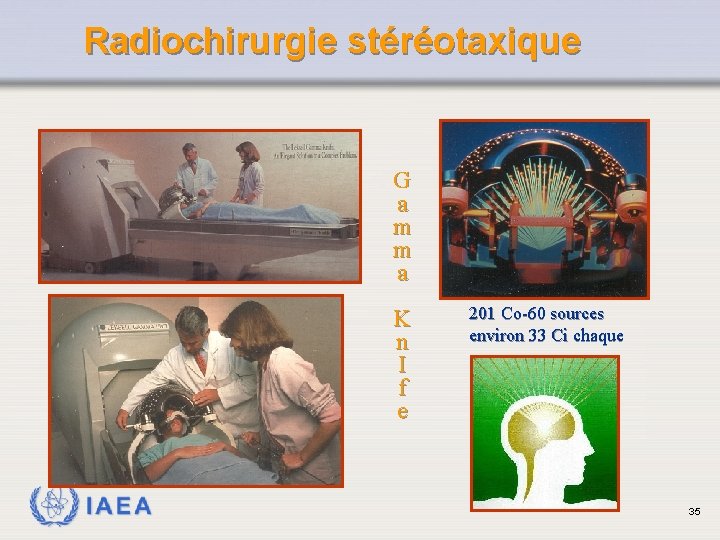 Radiochirurgie stéréotaxique G a m m a K n I f e IAEA 201