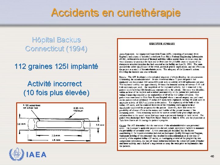  Accidents en curiethérapie Hôpital Backus Connecticut (1994) 112 graines 125 I implanté Activité
