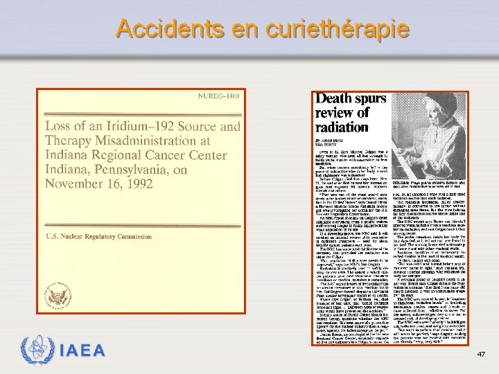  Accidents en curiethérapie IAEA 47 