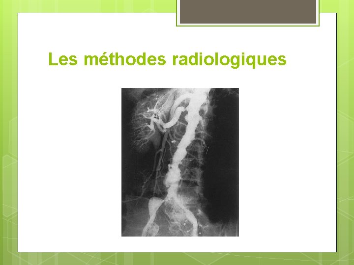 Les méthodes radiologiques 