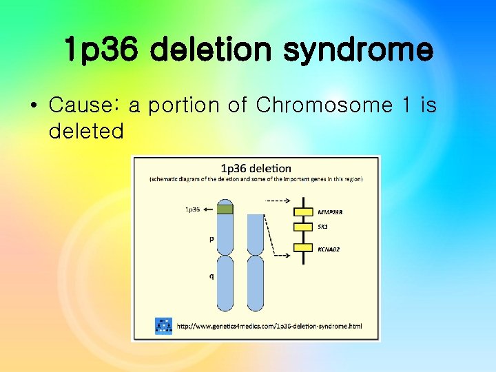 1 p 36 deletion syndrome • Cause: a portion of Chromosome 1 is deleted 1 p 36 deletion syndrome • Cause: a portion of Chromosome 1 is deleted