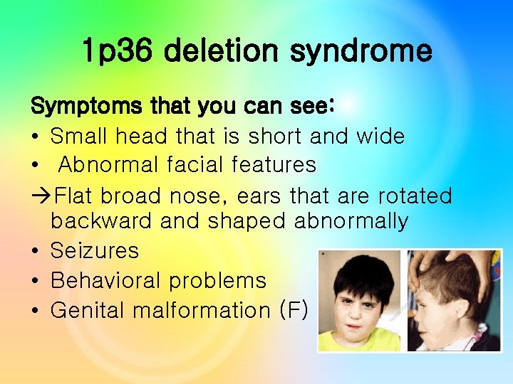 1 p 36 deletion syndrome Symptoms that you can see: • Small head that 1 p 36 deletion syndrome Symptoms that you can see: • Small head that