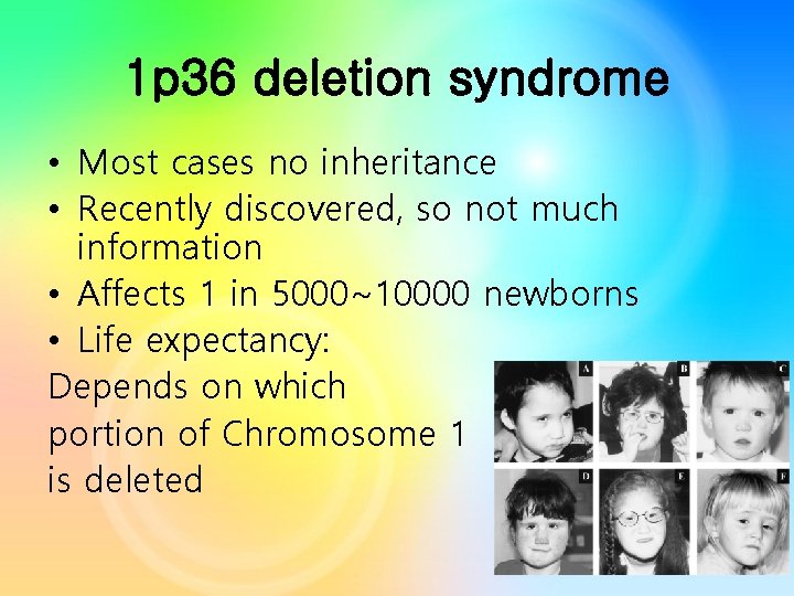 1 p 36 deletion syndrome • Most cases no inheritance • Recently discovered, so 1 p 36 deletion syndrome • Most cases no inheritance • Recently discovered, so