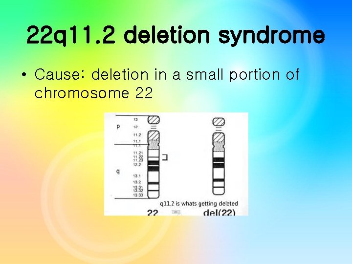 22 q 11. 2 deletion syndrome • Cause: deletion in a small portion of 22 q 11. 2 deletion syndrome • Cause: deletion in a small portion of