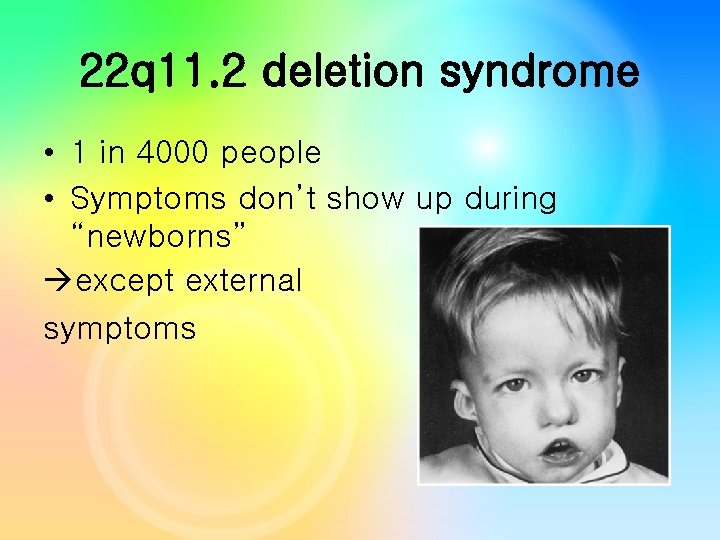 22 q 11. 2 deletion syndrome • 1 in 4000 people • Symptoms don’t 22 q 11. 2 deletion syndrome • 1 in 4000 people • Symptoms don’t