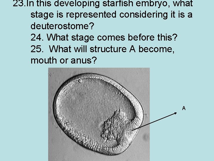 23. In this developing starfish embryo, what stage is represented considering it is a