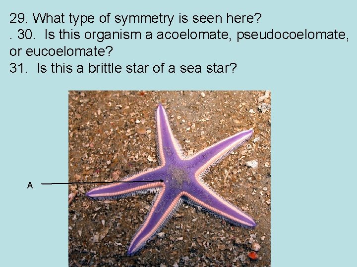 29. What type of symmetry is seen here? . 30. Is this organism a