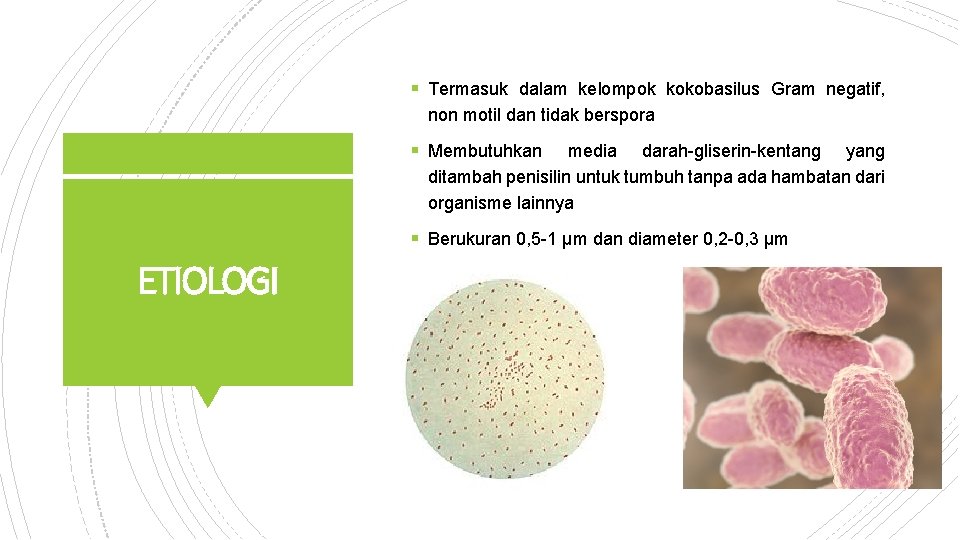 § Termasuk dalam kelompok kokobasilus Gram negatif, non motil dan tidak berspora § Membutuhkan