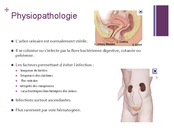 + Physiopathologie n L‘arbre urinaire est normalement stérile. n Il se colonise ou s’infecte