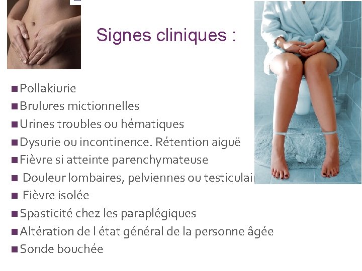 + Signes cliniques : n Pollakiurie n Brulures mictionnelles n Urines troubles ou hématiques