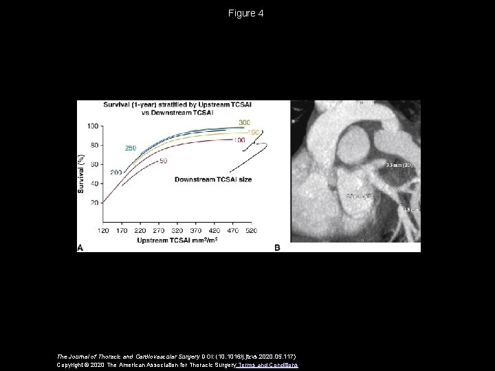 Figure 4 The Journal of Thoracic and Cardiovascular Surgery DOI: (10. 1016/j. jtcvs. 2020.