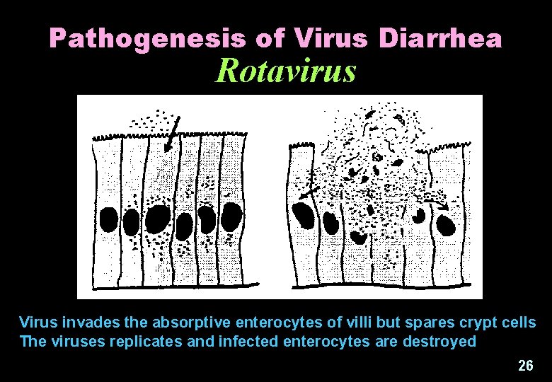 Pathogenesis of Virus Diarrhea Rotavirus Virus invades the absorptive enterocytes of villi but spares