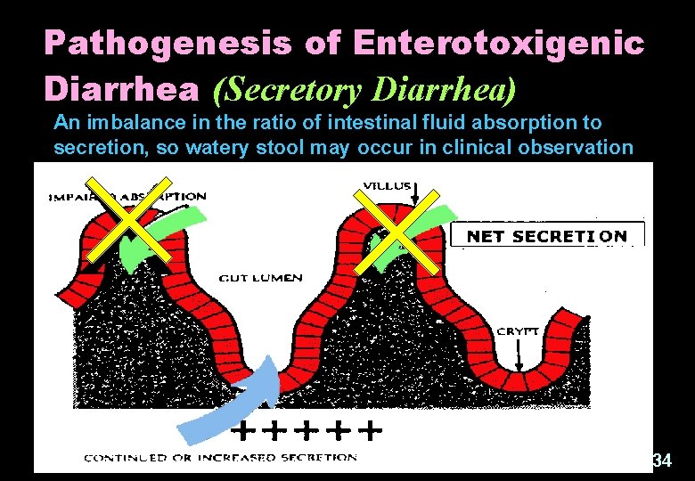 Pathogenesis of Enterotoxigenic Diarrhea (Secretory Diarrhea) An imbalance in the ratio of intestinal fluid