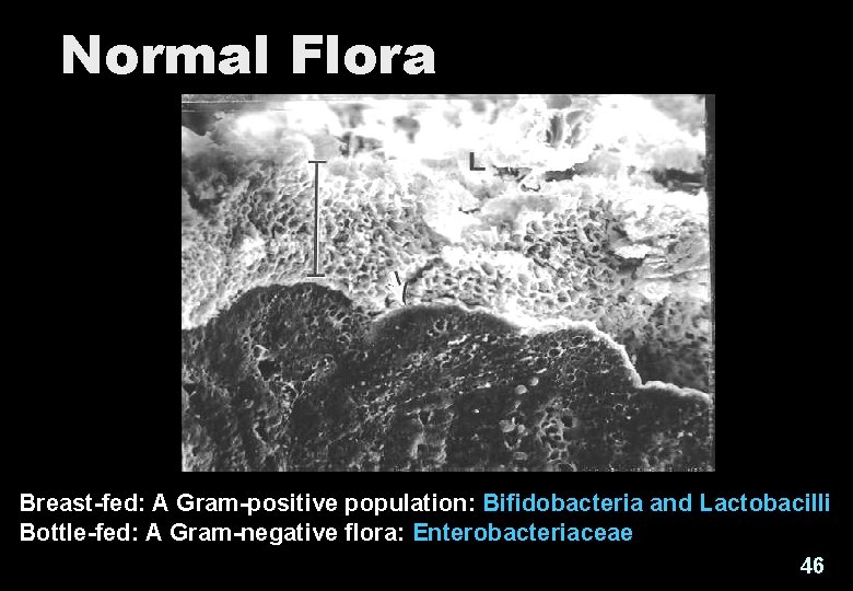 Normal Flora Breast-fed: A Gram-positive population: Bifidobacteria and Lactobacilli Bottle-fed: A Gram-negative flora: Enterobacteriaceae