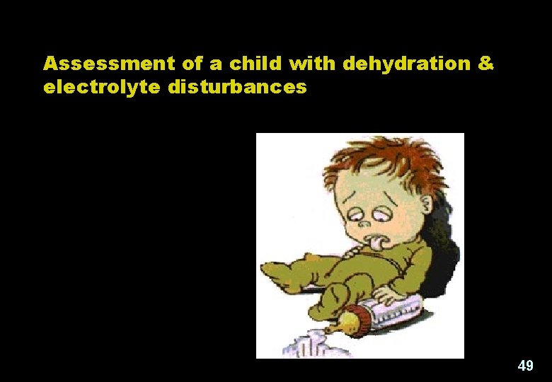 Assessment of a child with dehydration & electrolyte disturbances 49 