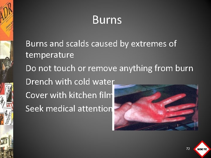 Burns and scalds caused by extremes of temperature Do not touch or remove anything
