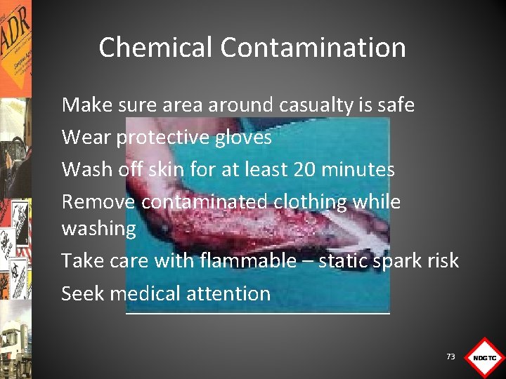 Chemical Contamination Make sure area around casualty is safe Wear protective gloves Wash off