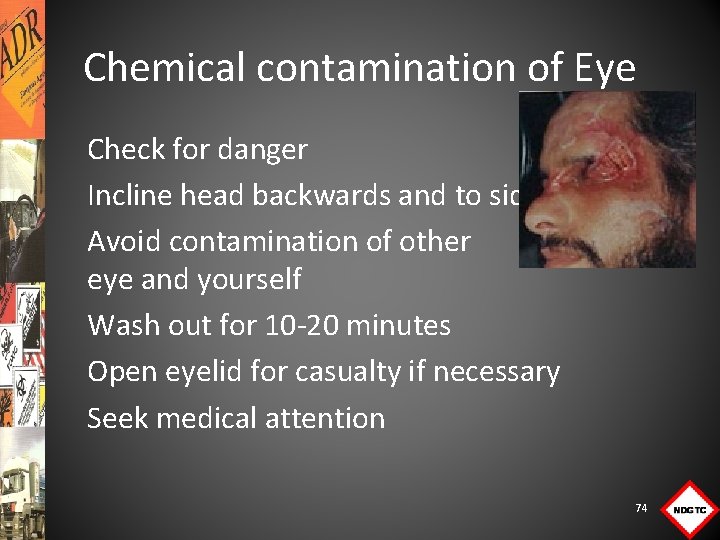 Chemical contamination of Eye Check for danger Incline head backwards and to side Avoid