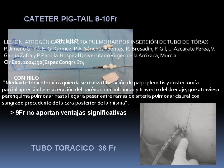 CATETER PIG-TAIL 8 -10 Fr SIN HILO CON HILO “Mediante toracotomía izquierda se realiza