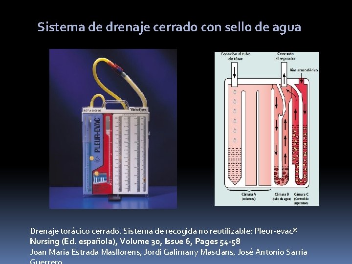 Sistema de drenaje cerrado con sello de agua Drenaje torácico cerrado. Sistema de recogida