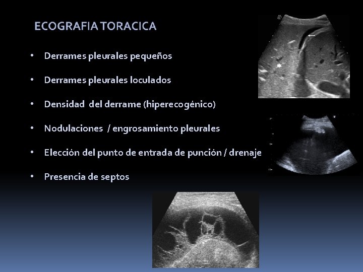  • Derrames pleurales pequeños • Derrames pleurales loculados • Densidad del derrame (hiperecogénico)