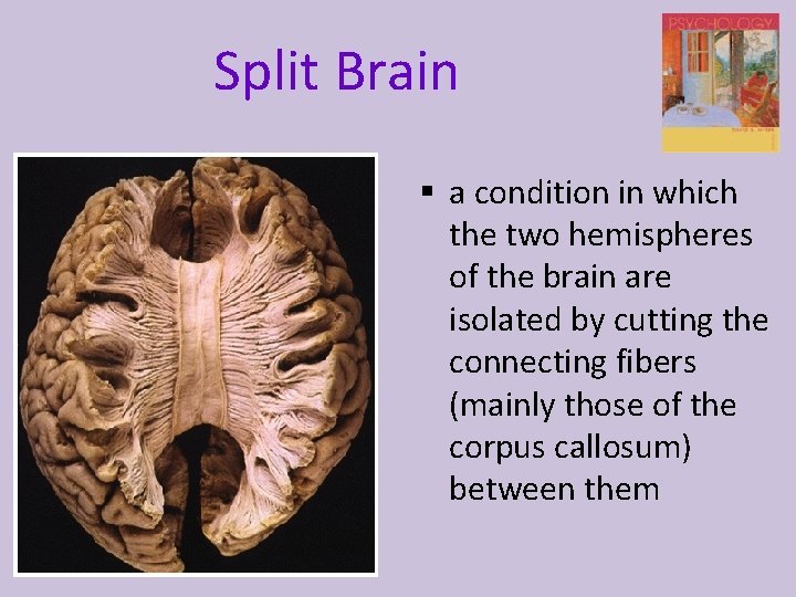Split Brain § a condition in which the two hemispheres of the brain are