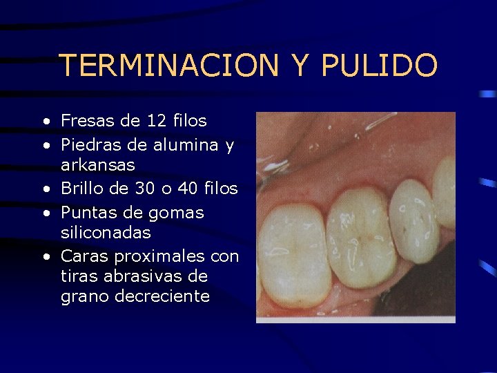 TERMINACION Y PULIDO • Fresas de 12 filos • Piedras de alumina y arkansas