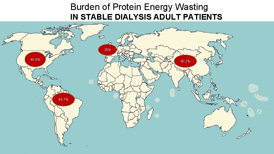 Burden of Protein Energy Wasting IN STABLE DIALYSIS ADULT PATIENTS 28% 46. 8% 60. Burden of Protein Energy Wasting IN STABLE DIALYSIS ADULT PATIENTS 28% 46. 8% 60.