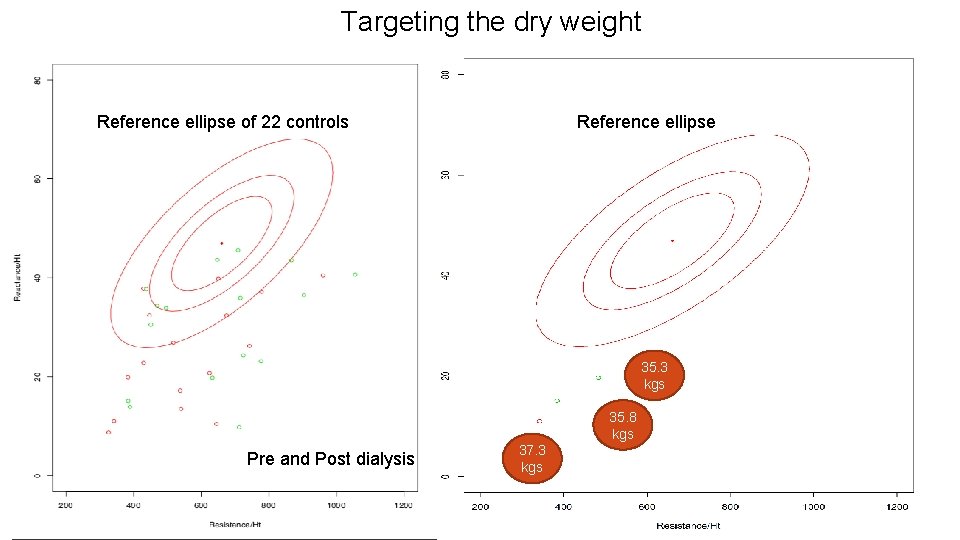 Targeting the dry weight Reference ellipse of 22 controls Reference ellipse 35. 3 kgs Targeting the dry weight Reference ellipse of 22 controls Reference ellipse 35. 3 kgs