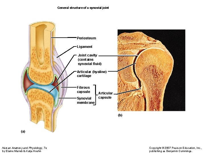 General structure of a synovial joint Periosteum Ligament Joint cavity (contains synovial fluid) Articular