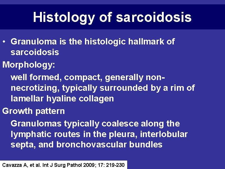 Histology of sarcoidosis • Granuloma is the histologic hallmark of sarcoidosis Morphology: well formed,