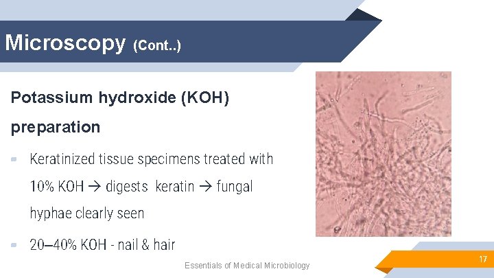 Microscopy (Cont. . ) Potassium hydroxide (KOH) preparation ▰ Keratinized tissue specimens treated with