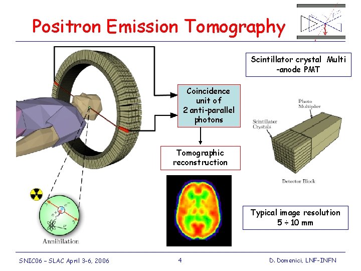 Positron Emission Tomography Scintillator crystal Multi -anode PMT Coincidence unit of 2 anti-parallel photons