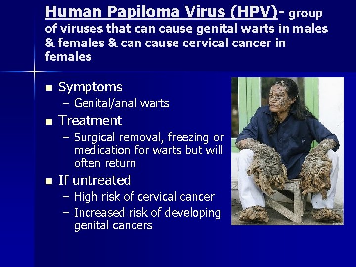 Human Papiloma Virus (HPV)- group of viruses that can cause genital warts in males