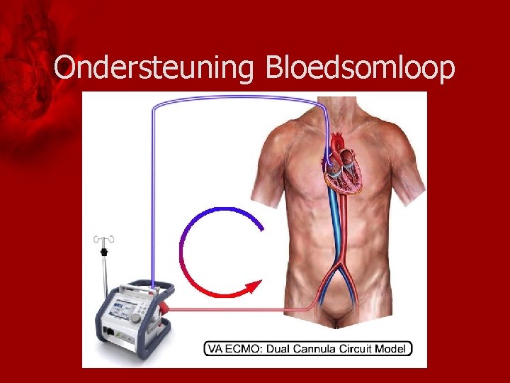 Ondersteuning Bloedsomloop 