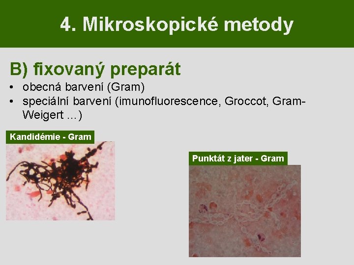 4. Mikroskopické metody B) fixovaný preparát • obecná barvení (Gram) • speciální barvení (imunofluorescence,